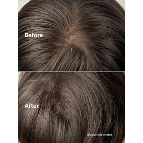 Horace Gentle Scalp Exfoliator