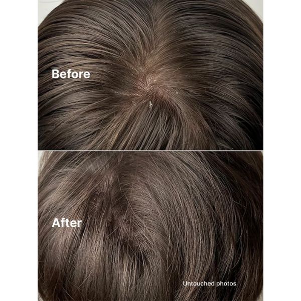 Horace Gentle Scalp Exfoliator